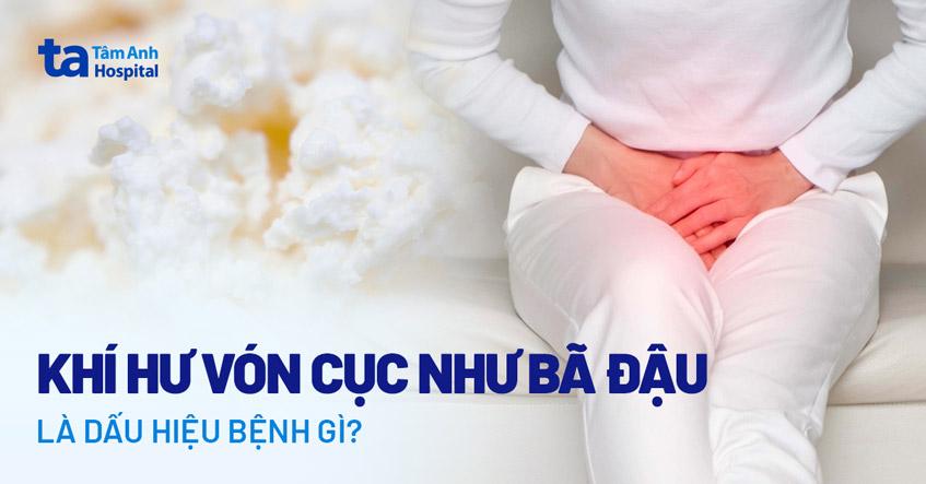 khí hư vón cục như bã đậu