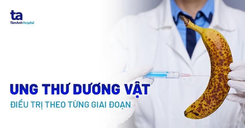 Cách điều trị ung thư dương vật hiệu quả cao theo từng giai đoạn