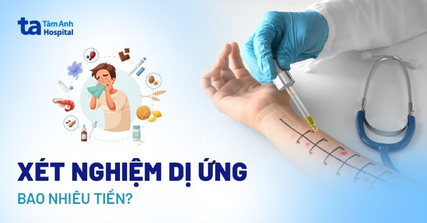 xét nghiệm dị ứng bao nhiêu tiền