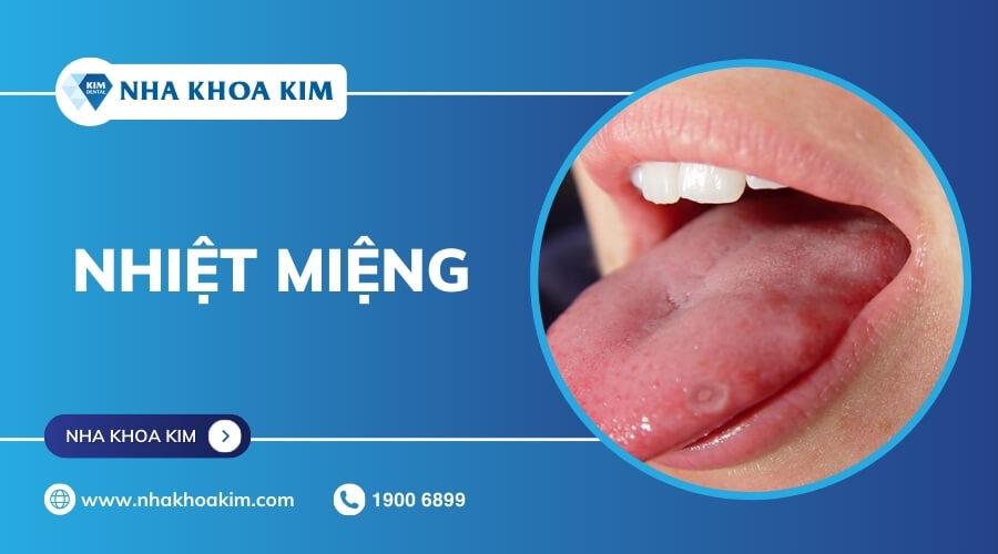 Lưỡi nổi hạt đỏ do nhiệt miệng