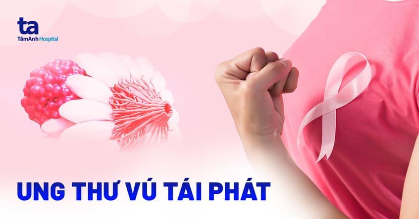 ung thư vú tái phát