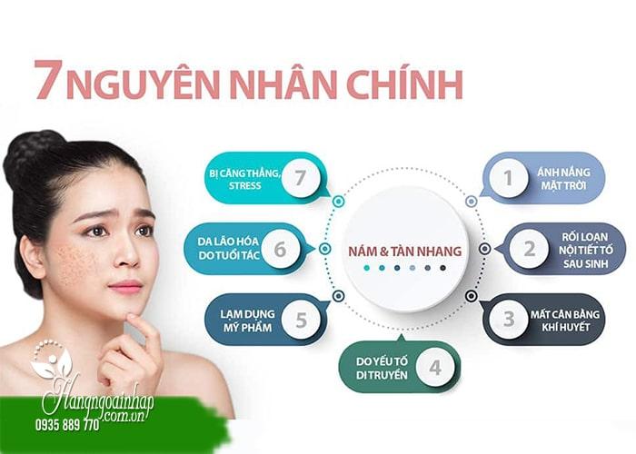 Review top 6 kem trị nám trắng da hiệu quả nhất hiện nay